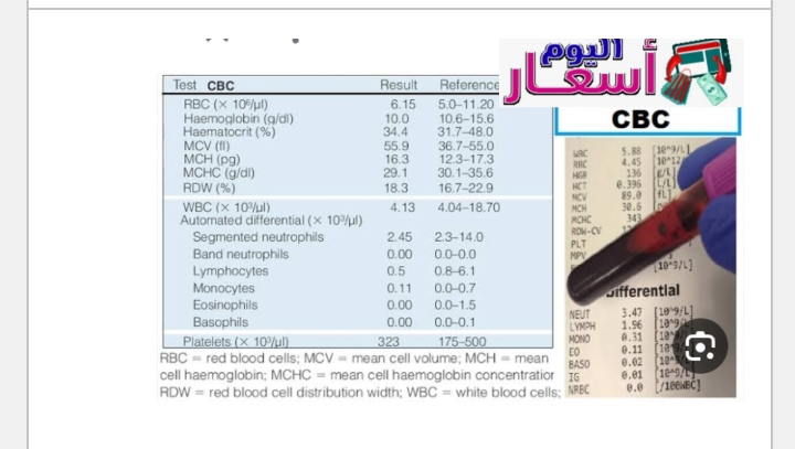 سعر تحليل cbc